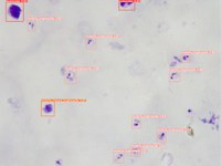 Development of an automated diagnostic system for malaria and urogenital schistosomiasis using artificial intelligence tools and a low-cost universal robotic microscope
