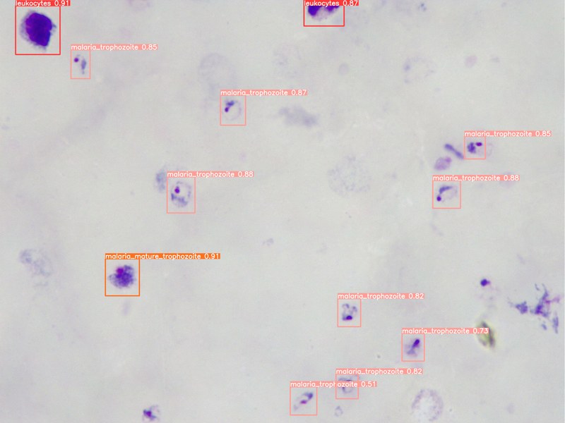 Desarrollo de un sistema de diagnóstico automatizado por la malaria y la esquistosomiasis urogenital utilizando herramientas de inteligencia artificial y un microscopio robotizado universal de bajo coste