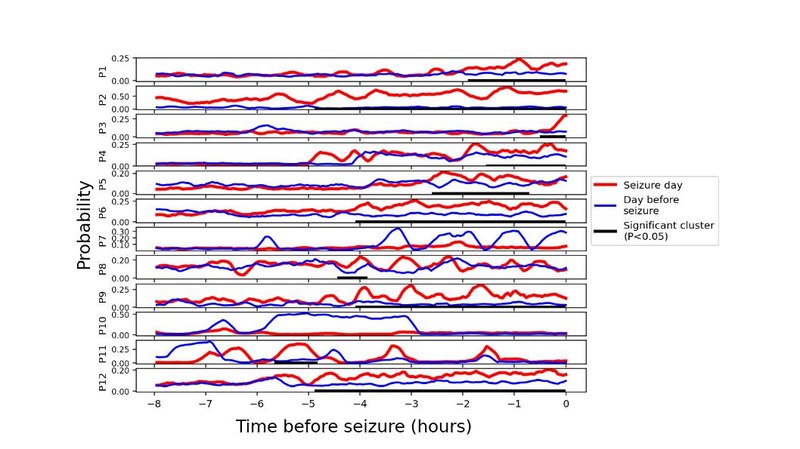 Estados de alta conectividad preictal en la epilepsia: Evidencia del EEG intracraneal, interacción con la zona de inicio de las crisis y modelado de redes